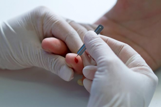 Снимка: medicaldaily.com Снимка: medicaldaily.com